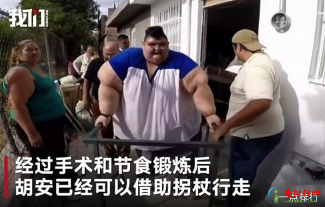 世界上最胖的人减660斤 每天能自己起床就感到很